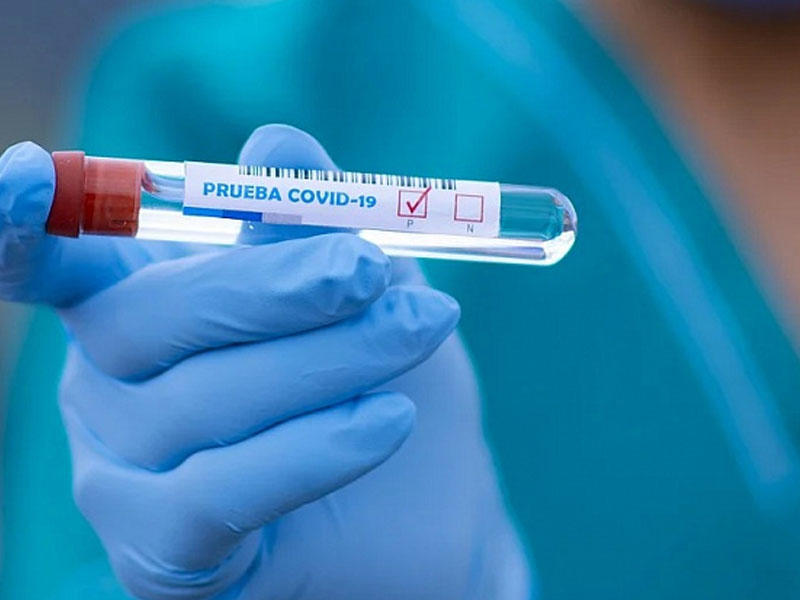 Gürcüstanda koronavirusa yoluxanların sayı 916 mini keçib