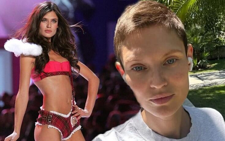 Xərçənglə mübarizə aparan model "Victoria's Secret" şousuna qəbul edilmədi