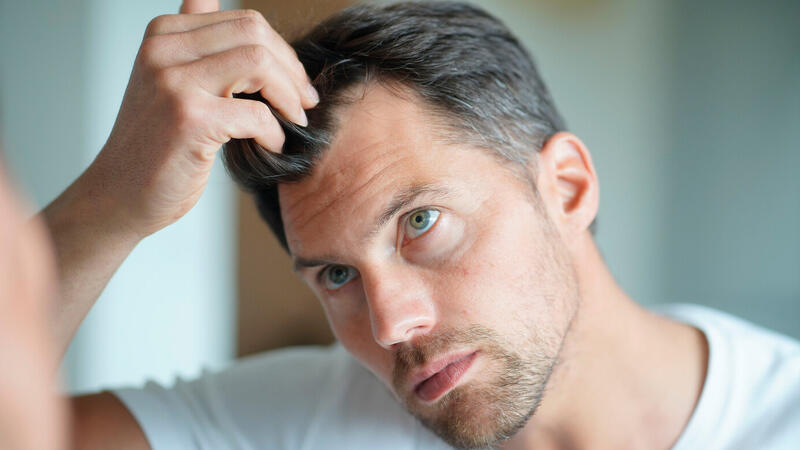 Kişilərdə 30 yaşına &ccedil;atmadan sa&ccedil;ları niyə t&ouml;k&uuml;l&uuml;r?