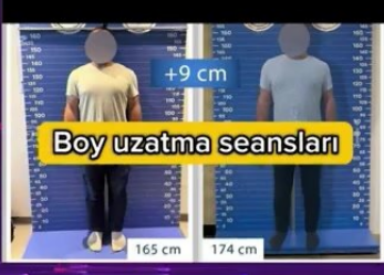 Sosial şəbəkələrdə paylaşılan aparatla 9 santimentrə qədər boy uzadılır? 