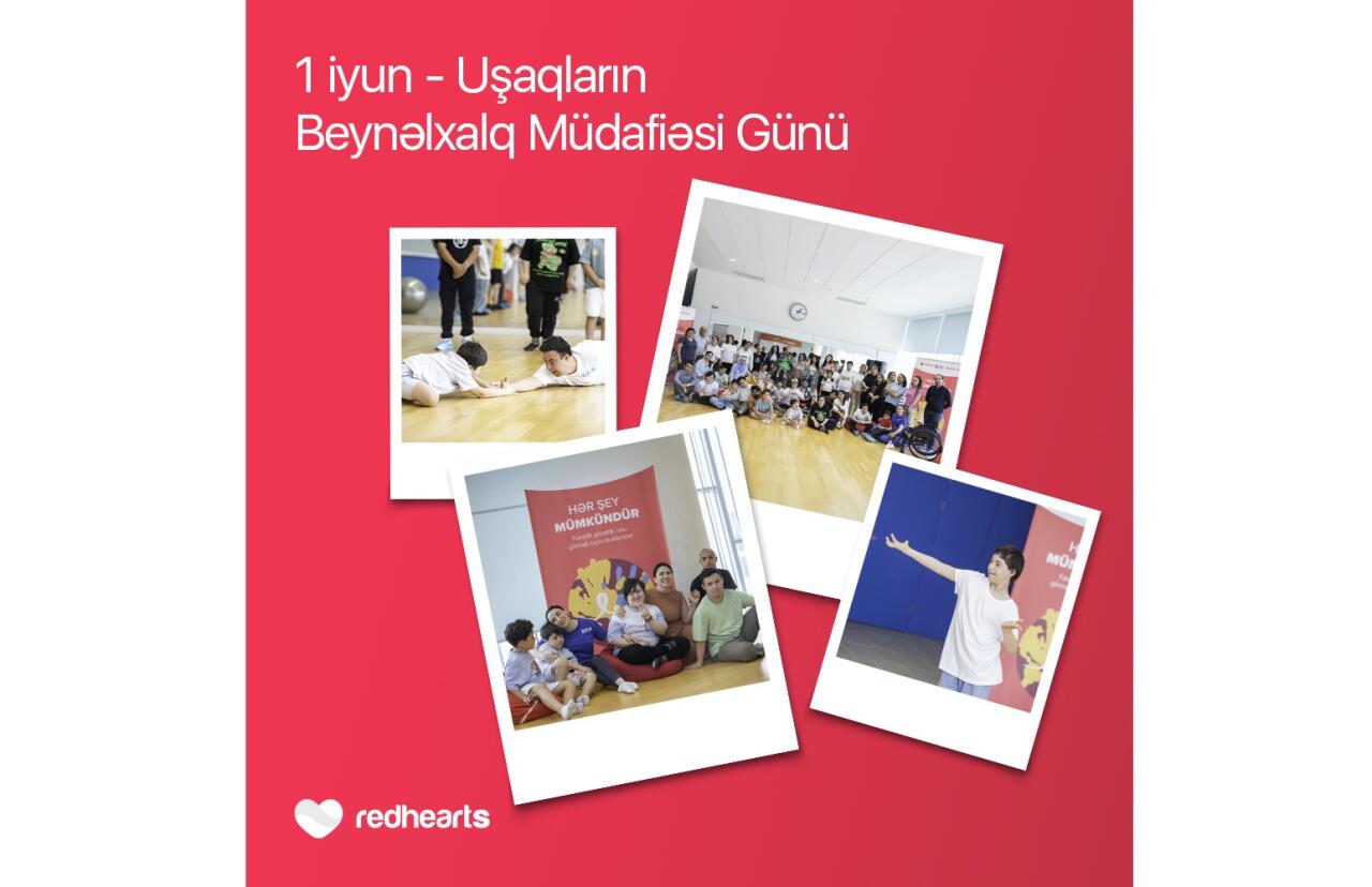 Hər şey mümkündür: Daun sindromlu uşaqlar üçün sosial layihə