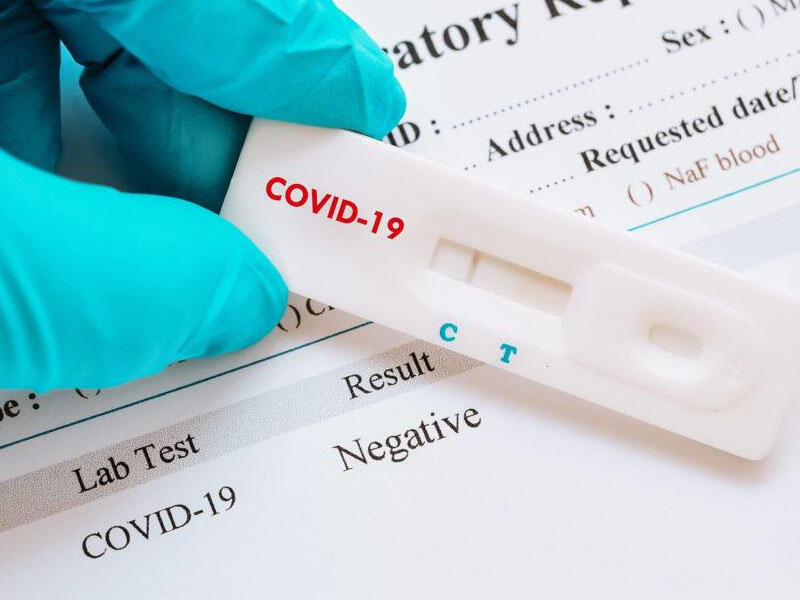 Azərbaycanda 20 mindən çox koronavirus testi istehsal olunub