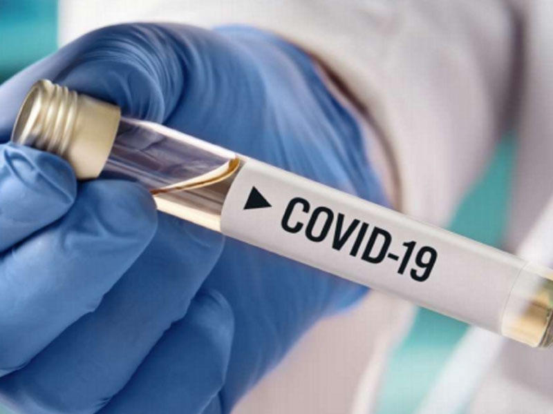 Gürcüstanda daha 8 767 nəfərdə koronavirus aşkarlanıb, 49 nəfər ölüb