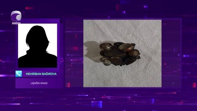 Batareya və maqnit qırıntıları udan 10 yaşlı uşağın anası DANIŞDI 