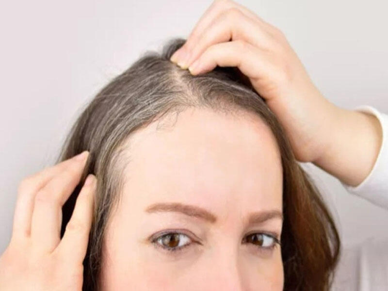 Erkən yaşda saç ağarmasının qarşısını almağın