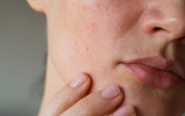 Dəri xərçəngindən bu sadə üsulla qorunmaq olar