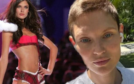 Xərçənglə mübarizə aparan model "Victoria's Secret" şousuna qəbul edilmədi