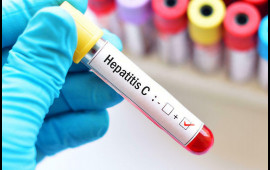 Hepatit Cnin təbii yollarla müalicəsi