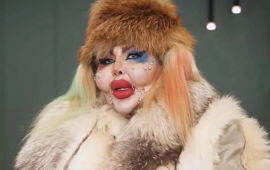 İranlı bloqer estetik əməliyyatlarına g&ouml;rə rekord qırdı