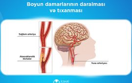 Bu müalicə də icbari tibbi sığortaya daxildir