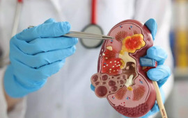 Səhər vərdişləri böyrəklərinizi məhv edə bilər – 5 təhlükəli səhv