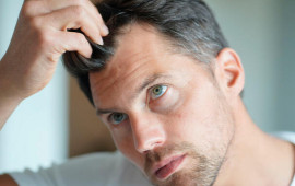 Kişilərdə 30 yaşına &ccedil;atmadan sa&ccedil;ları niyə t&ouml;k&uuml;l&uuml;r?