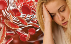 Anemiya yarada biləcək xəstəlik açıqlanıb