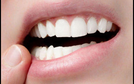 Diş itkisi ölüm riskini artıra bilər  ARAŞDIRMA