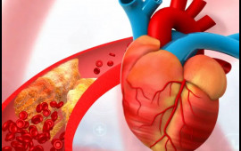 Duz, alkoloq, qəhvəni eyni vaxtda qəbul etmək olmaz  Damarlar dözməyəcək