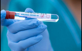 Gürcüstanda son sutkada koronavirusdan 65 nəfər ölüb
