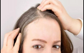 Erkən yaşda saç ağarmasının qarşısını almağın