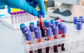 "Qızıl qan": Dünyada cəmi 50 nəfərdə olan ən nadir qan qrupu niyə vacibdir?