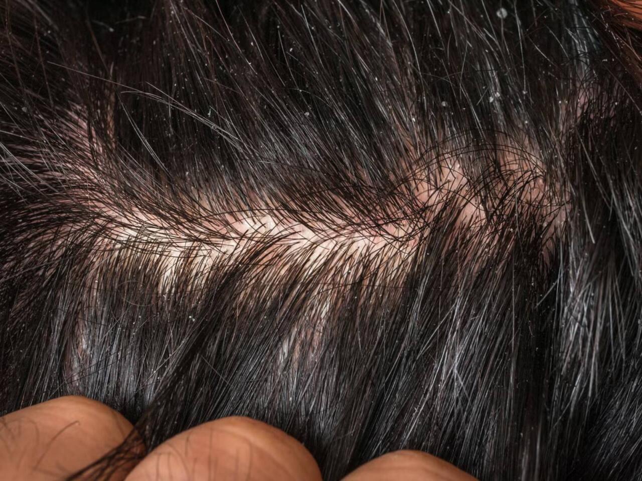 &Ccedil;ox addam ciddiyə almır  Ağır xəstəliklərin əlaməti ola bilər