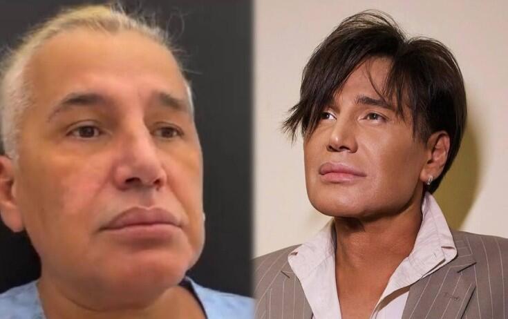 Samir Bağırov plastik əməliyyatdan əvvəl  Video