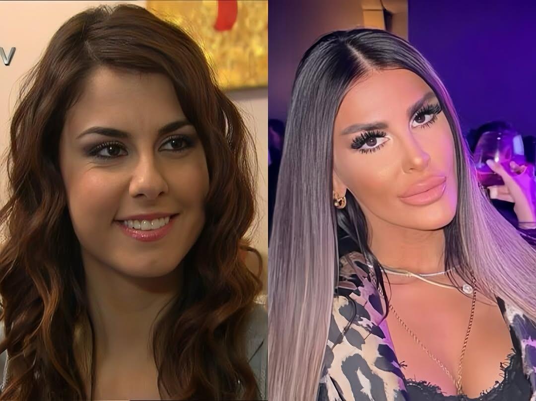 &ldquo;Adanalı&rdquo;nın Pınarı tanınmaz halda 