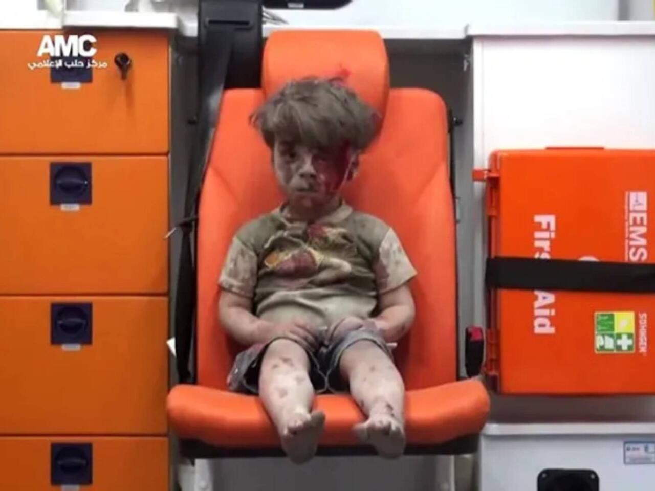 9 il əvvəl hamını məyus etmişdi  İndiki halı diqqət çəkdi  FOTO