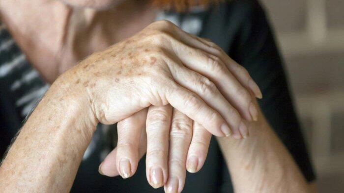 Əllərin dərisini necə cavanlaşdırmaq olar? Yaşınızı ələ verməsin