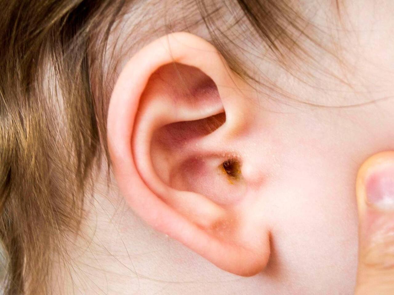 Uşaqlarınızda bu əlamətlər varsa, həkimə aparın  Yoxsa kar qala bilər