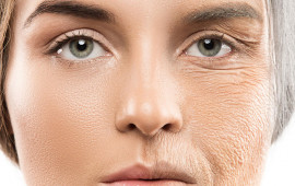 Yaşlanmanın ilk izi  G&ouml;z ətrafı &uuml;&ccedil;&uuml;n doğru baxım necə olmalıdır?