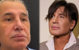 Samir Bağırov plastik əməliyyatdan əvvəl  Video