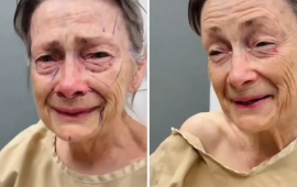 Estetik əməliyyatdan sonra inanılmaz dəyişim 