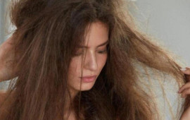 Saçları korlayan 6 pis VƏRDİŞ