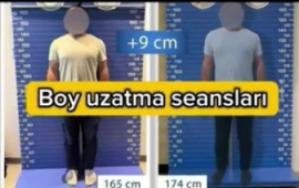 Sosial şəbəkələrdə paylaşılan aparatla 9 santimentrə qədər boy uzadılır? 