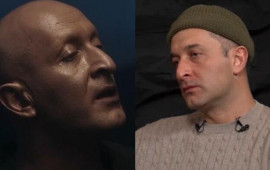 "Oğlum məni g&ouml;rəndə qorxub ağladı, elə bildi ciddi xəstəliyim var"