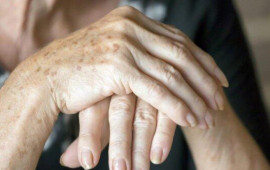 Əllərin dərisini necə cavanlaşdırmaq olar? Yaşınızı ələ verməsin