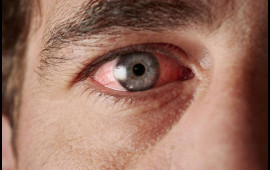 Gərginsinizsə bu vitamininiz çatışmır