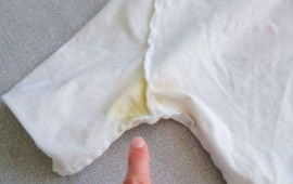 Tiş&ouml;rtlərin qoltuqaltı saralmalarını s&uuml;rətlə ağardan ev &uuml;sulu