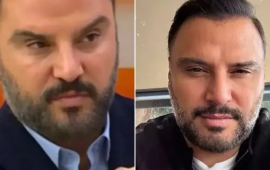 Alişan botoks etdirdiyini belə etiraf etdi 