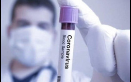 Koronavirusla bağlı həftəlik statistika açıqlandı 